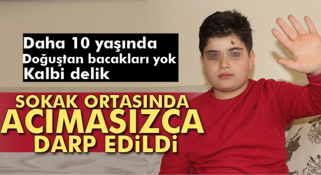 Doğuştan bacakları olmayan küçük Miraç, şehir magandalarının hedefi oldu