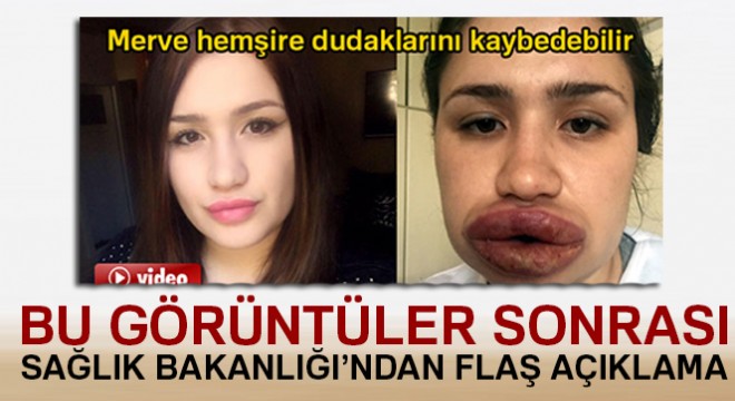 Sağlık Bakanlığından  sahte estetik  açıklaması